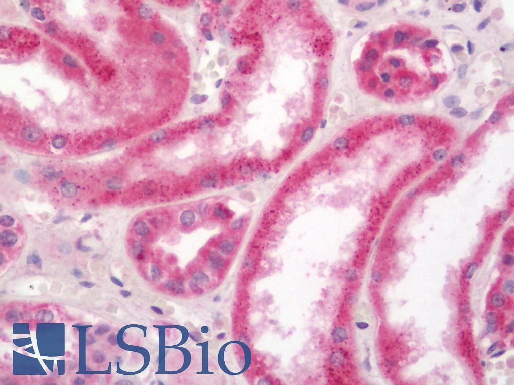 IHC-plus™ SDHA Antibody