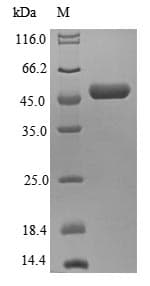 Human EIF3K Protein (Recombinant GST, N-terminus)