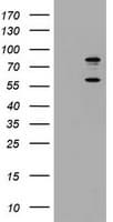 Monoclonal Mouse anti-Human TICAM1 / TRIF Antibody (clone OTI1G7, WB)