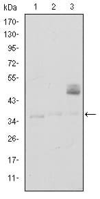 CD1A Antibody (clone 7A7)
