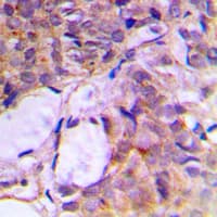 CNKSR2 Antibody (Internal)