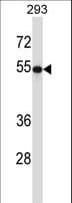 TUBB2A / Tubulin Beta 2A Antibody (aa410-438)