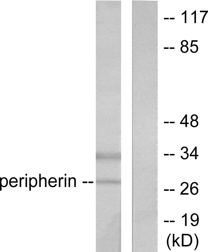 PathPlus™ UCHL1 / PGP9.5 Antibody (aa171-220)