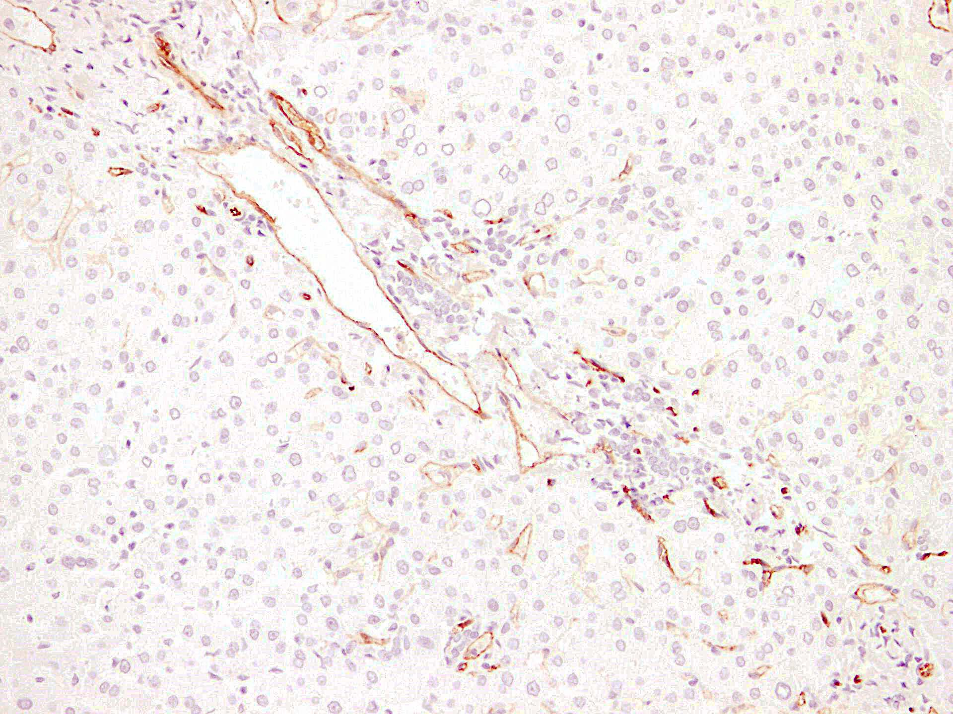 IHC-plus™ CD34 Antibody (clone ABT-CD34)