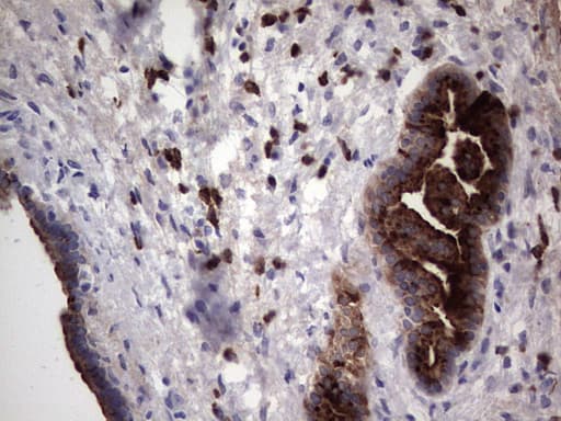MMP7 / Matrilysin Antibody (aa95-267, clone OTI3G7)