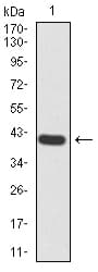Monoclonal Mouse anti-Human RALA / RAL Antibody (clone 4G8C7, IHC, WB)