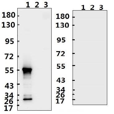 Polyclonal Rabbit anti-Coronavirus SARS-CoV-2 Nucleoprotein Antibody (aa 335-349, WB)