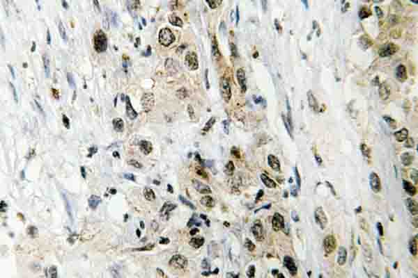 TAF5 Antibody (Gly411)