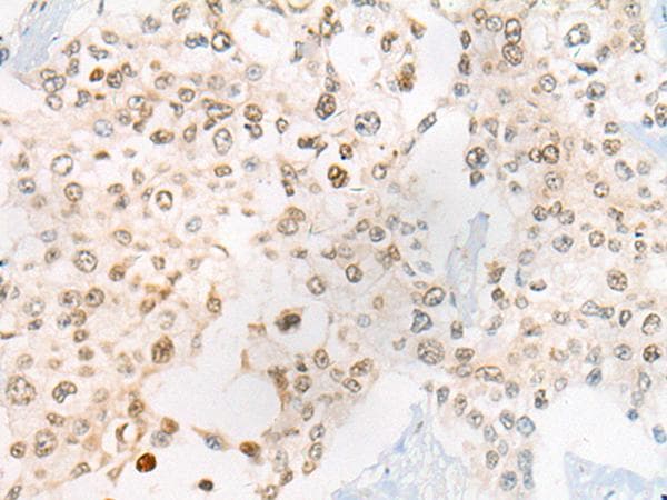 Polyclonal Rabbit anti-Human CEP72 Antibody (IHC)