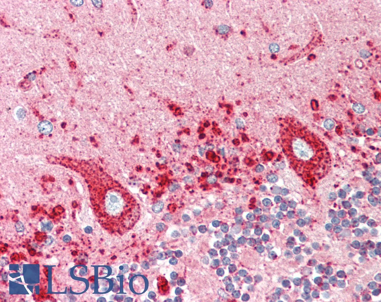 IHC-plus™ Monoclonal Mouse anti-Human LAMP1 / CD107a Antibody (clone 5H6, aa32-350, IHC, IF, WB)