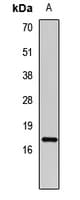 Polyclonal Rabbit anti-Human CAV3 / Caveolin 3 Antibody (IHC, WB)