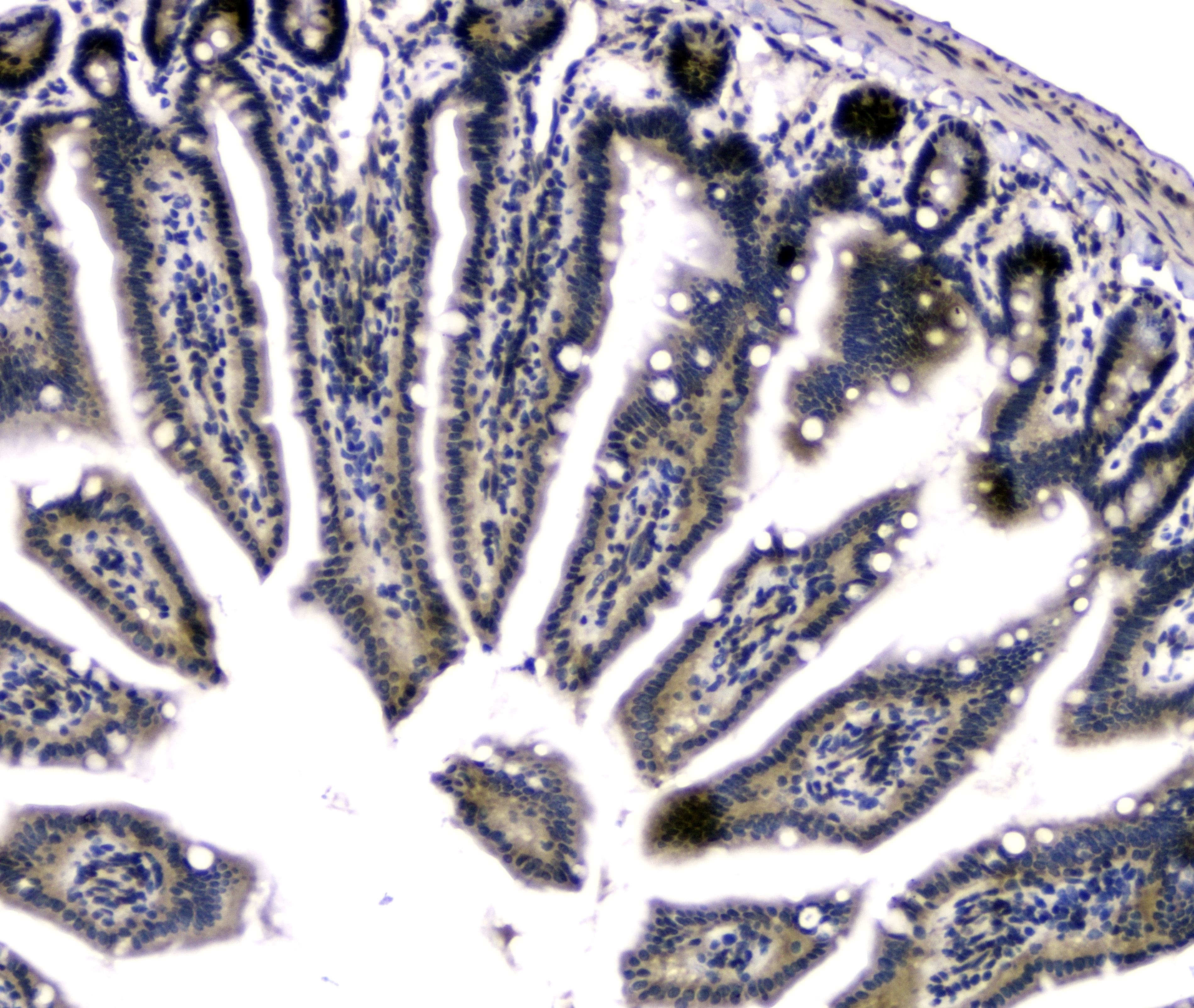 DCK / Deoxycytidine kinase Antibody