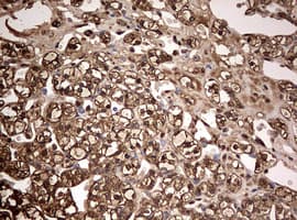 Monoclonal Mouse anti-Human GAPDH Antibody (clone OTI2F9, IHC, WB)