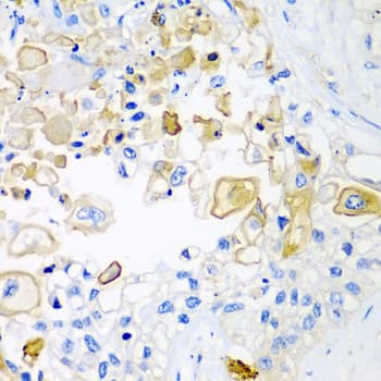 Polyclonal Rabbit anti-Human HAVCR2 / TIM-3 Antibody (aa22-202, IHC, WB)