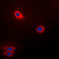 FUT3 Antibody (Internal)