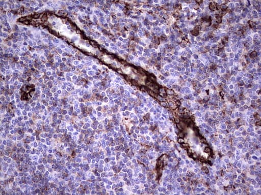 PECAM-1 / CD31 Antibody (clone UMAB164)
