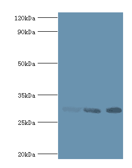 Polyclonal Rabbit anti-Human CA1 / Carbonic Anhydrase I Antibody (aa1-261, IHC, WB)