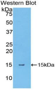 TSLP Antibody (aa25-146)