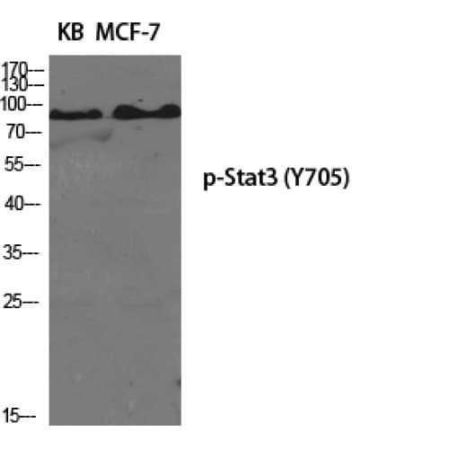 Polyclonal Rabbit anti-Human STAT3 Antibody (640-720 aa, IHC, WB)