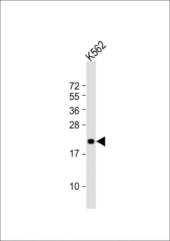 FEV / PET1 Antibody (aa17-49)