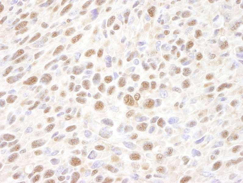 Polyclonal Rabbit anti-Human VCP Antibody (aa750-C-term, IHC)