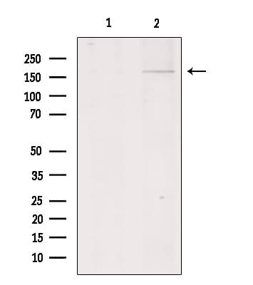 COL11A1 / Collagen XI Alpha 1 Antibody