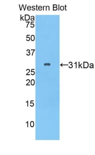 PITRM1 / MP1 Antibody (aa544-806)
