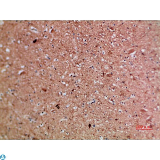 ARTN / Artemin Antibody