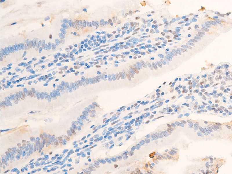 NR3C1/Glucocorticoid Receptor Antibody (phospho-Ser203)