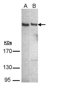 Polyclonal Rabbit anti-Human PLCH1 Antibody (aa548-871, WB)