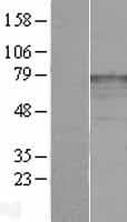 KATNB1 Protein (Over-Expression Lysate Myc-DDK (Flag))
