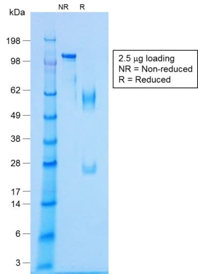 Recombinant Monoclonal Rabbit anti-Human NKX2-2 Antibody (clone NX2/1422R, IHC)