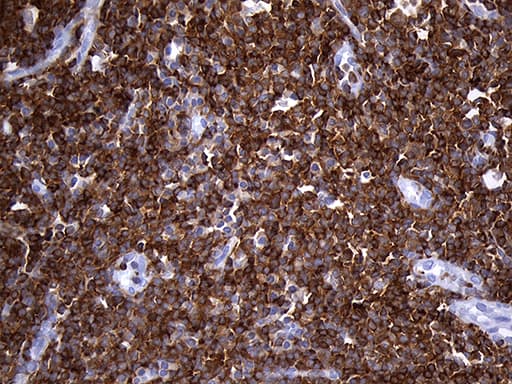 SH3BP1 Antibody (clone OTI1C9, Carrier-free)