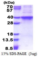 Human RAD51L3 / RAD51D Protein (Recombinant His)