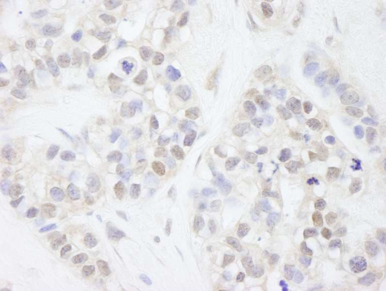 Polyclonal Rabbit anti-Human MAGED2 Antibody (aa50-100, IHC)