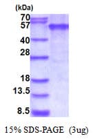 Human EDAR Protein (Recombinant His)