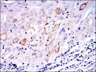 Monoclonal Mouse anti-Human MAP2K7 / MEK7 Antibody (clone 400000, IHC, IF, WB)
