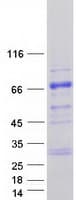 Human TESK2 Protein (Recombinant Myc-DDK (Flag))