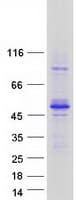 Human TES / Testin Protein (Recombinant Myc-DDK (Flag))