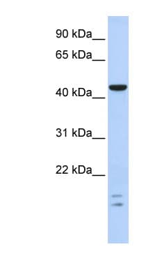 BTBD6 Antibody (C-Terminus)