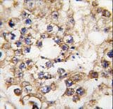 PDX1 Antibody (aa40-69)