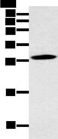 YRDC Antibody