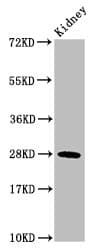 HIST1H1C Antibody