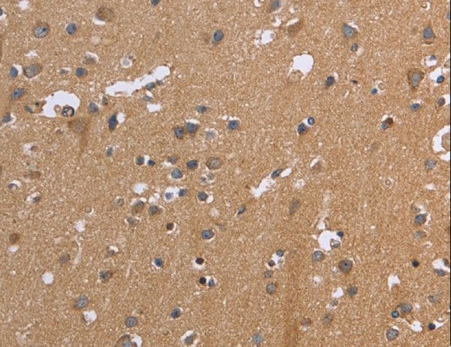 Polyclonal Rabbit anti-Human KIAA1324 / maba1 Antibody (IHC)