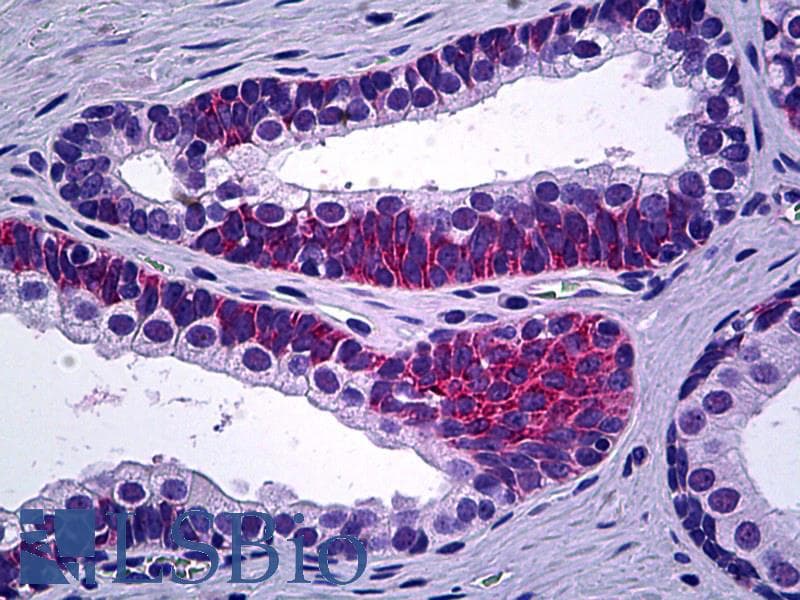 IHC-plus™ PPP3CC / CALNA3 Antibody (aa18-47)
