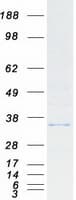 Human CYB5R1 Protein (Recombinant Myc-DDK (Flag))