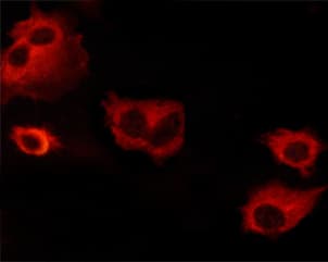 Polyclonal Rabbit anti-Human BCL2L1 / BCL-XL Antibody (phospho-Thr47, IHC, IF, WB)