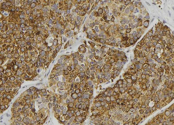 ALMS1 Antibody