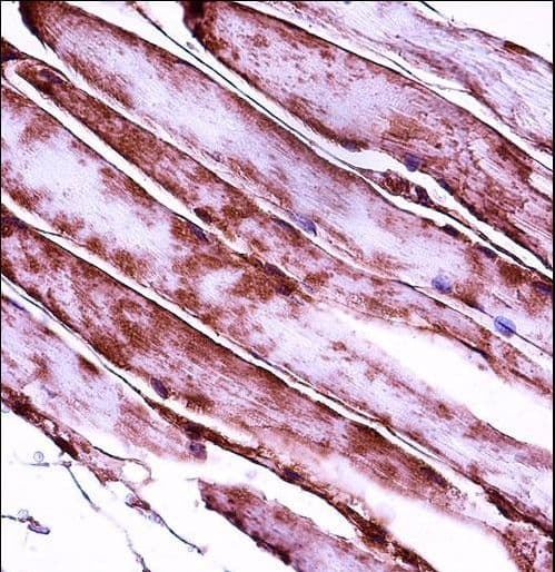 Polyclonal Rabbit anti-Human MYL3 Antibody (aa1-30, IHC, WB)