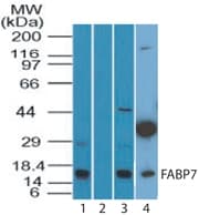 IHC-plus™ Polyclonal Rabbit anti-Human FABP7 / BLBP / MRG Antibody (aa80-130, IHC, WB)